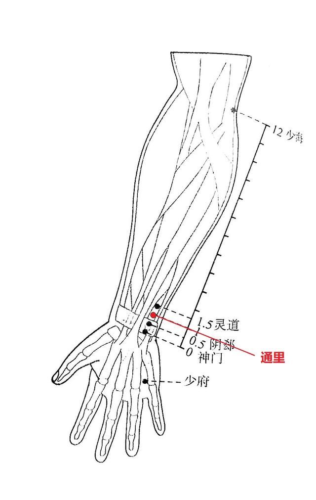通里穴的妙用